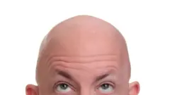 Un hombre pelado se mira la cabeza