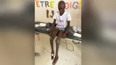 Serigne after treatment
