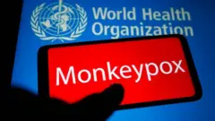 ਮੰਕੀਪੌਕਸ