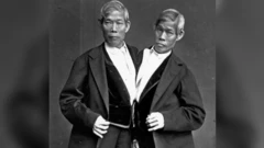 Chang y Eng Bunker