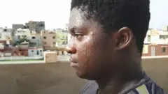 Yanis Cauffy, 20 ans, un jeune qui souffre de l'acné
