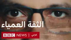 أكثر من مليوني شخص في جميع أنحاء العالم مصابون بالتهاب الشبكية الصباغي، ولكن بالنسبة لمعظمهم لا يوجد علاج