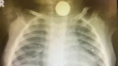 أشعة