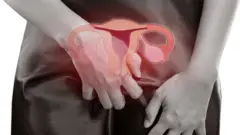 Montaje de la pelvis de una mujer con una ilustración de sus órganos reproductivos supuerpuesta