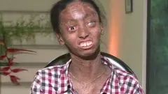 special genetic condition