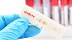 teste positivo de coronav[irus