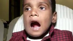 د هند په چینای ښار کې ډاکټرانو د یوه اوه کلن ماشوم له خولې څه باندې ۵۰۰ اضافي غاښونه ایستلي او ۲۱ غاښونه یې ورته پرېښي دي. نور وېډیو کې کتلی شئ.