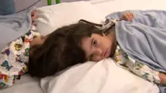 بعد سلسلة من الجراحات المعقدة، تمكنت مجموعة من الجراحين في بريطانيا من فصل التوأمين الملتصقين مروة وصفاء