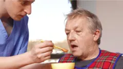 அல்சைமர்