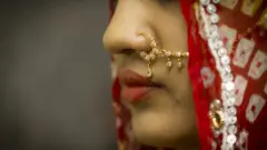 પ્રતીકાત્મક તસવીર
