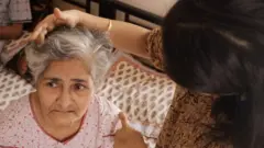 الزایمر