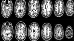 Imágenes de resonancia magnética del cerebro