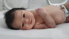 भूकंप में बची सीरियाई बच्ची अया