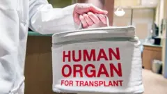 বিশ্বের প্রায় সব দেশেই টাকার জন্য কিডনি বিক্রি করা বেআইনি।