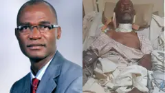 Foto Mazị Okechukwu Akaneme na oge ọ nọ n'akwa ọrịa n'ụlọgwụ Memfys dịka a wara ya ahụ iji dozie olu ya gbajiri agbaji