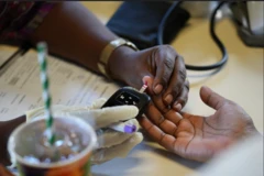 Ọwa tí wọ́n ń gba ẹ̀jẹ̀ lára rẹ̀ láti fi ṣàyẹ̀wò ìtọ̀ ṣúgà