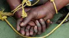 Ọkunrin ti wọn so ọwọ rẹ mọ ẹyin