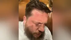 Леонид Волков после нападения