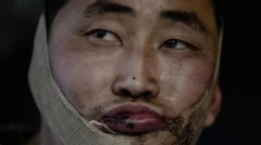 Ifoto yatangajwe na Perezida wa Ukraine Volodymyr Zelensky bivugwa ko igaragaza umwe mu basirikare babiri ba Koreya ya Ruguru bafashwe 