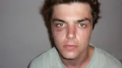 Will Adolphy usando uma camisa clara, olha diretamente para a câmera. Ele está com um roxo debaixo de um dos olhos.