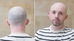 چهره مردی طاس با تیشرتی راهراه و سفید و سیاه، به دوربین نگاه میکند، یک گوشواره به گوش دارد