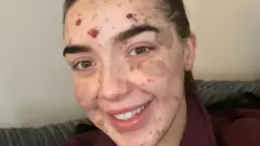 Laura has brown eyes and is wearing a red jacket.