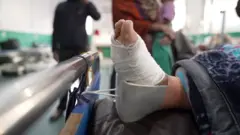 भूकम्पमा परेर घाइतेको खुट्टा।