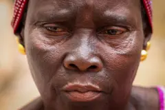 Visage d'une dame avec des taches noires