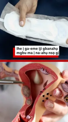 Ihe ị ga-eme iji gbanahụ mgbu ma ị na-ahụ nsọ gị