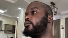 A head shot of Edgar Mwakabela taken from below with a scar around his jaw clearly visible.