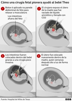 Gráfico