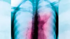 2024 World Tuberculosis Day: Ihe ị kwesịrị ịma maka ụkwara nta