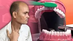 બીબીસી ગુજરાતી ટૂથબ્રશ ડૉક્ટર ગળાની નસ છત્તીસગઢના રાહુલકુમાર જાંગડે જ્યારે બ્રશ કરતા હતા ત્યારે તેમની ગળાની નસ ફાટી ગઈ હતી. ડૉક્ટર્સ અનુસાર, આ કોઈ ઈજા કે બીમારીના કારણે નહોતું થયું, પરંતુ એક દુર્લભ ઘટના હતી. તેમાં ગળામાં આવેલી મગજ સુધીની લોહી પહોંચાડતી નસ (આર્ટરી/ ધમની) આપમેળે જ ફાટી ગઈ હતી. હેલ્થ