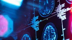 Exame de imagem de um cérebro