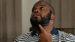 Ifoto igaragaza umutwe wa Edgar Mwakabela yafotorewe munsi igaragaza inkovu mu gice cyo ku rwasaya. Atunze urutoki ku kananwa. 