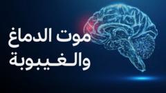 ما الفرق بين الموت الدماغي والغيبوبة؟