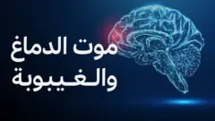 الدماغ