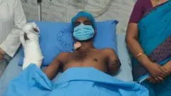 બીબીસી ગુજરાતી, ગુજરાત, બીબીસી, અમદાવાદ, ચેન્નાઈ, હાથની સર્જરી, કપાયેલા હાથ, મજૂર, અકસ્માત, હૉસ્પિટલ 