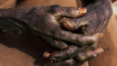 Wo ohun tí wàhálà àṣejù yóò ṣe sí àwọ̀ ara à rẹ nígbà tó bá rẹ̀ ọ́