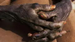 Ọwọ ti olootu rẹ papọ, ọwọ naa dudu, awọn eekanna rẹ si fi apẹẹrẹ wahala ṣiṣẹ han.