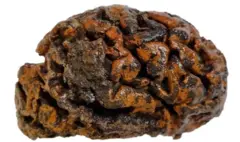 Um cérebro de 1.000 anos