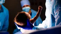 Bebê durante o parto