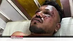 အဲ အိန္ဒိယ လေယာဉ်ပျက်ကျမှုက အသက်ရှင် လွတ်မြောက်လာသူ