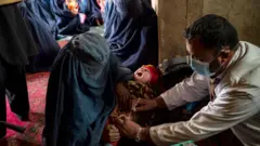polio 