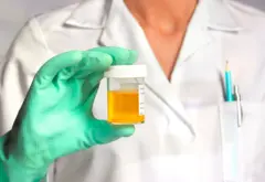 ਪਿਸ਼ਾਬ ਦਾ ਰੰਗ 