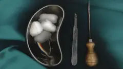 Freeman popularizou "lobotomias com picadores de gelo"