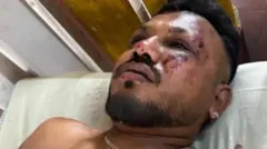 Višvaškumar Rameš, jedini preživeli iz aviona Er Indija koji se srušio na grad Ahmedabad odmah po poletanju za London