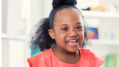 Girl with down syndrome