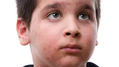 प्रतिनिधिक फोटो