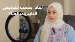  نور الأغا أصيبت به وهي في سن 22 ومرت برحلة طويلة حتى تم تشخيصها به